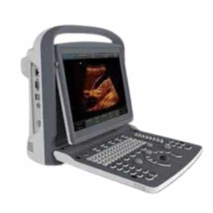 CHISON ECO-2 Color Digital Ultrasound Machine