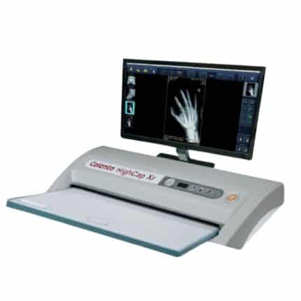 Colenta CR (Computed Radiography) System