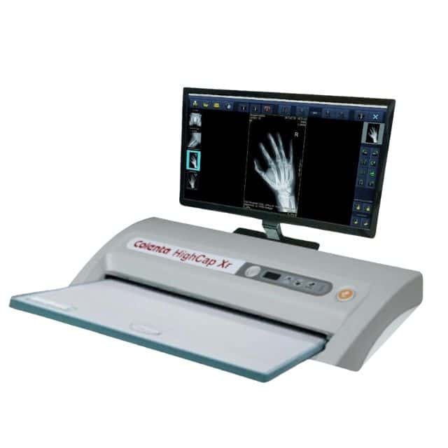 Colenta CR (Computed Radiography) System Colenta CR (Computed Radiography) System