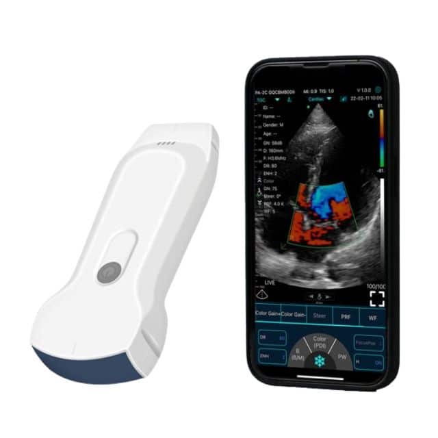 Dual-Probes Multipurpose Wireless Ultrasound – Convex + linear + Cardiac Probe Dual-Probes Multipurpose Wireless Ultrasound – Convex + linear + Cardiac Probe