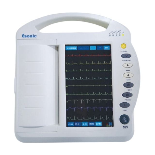 Esonic ECG – 1200C 12 Channel Digital ECG Machine Esonic ECG – 1200C 12 Channel Digital ECG Machine
