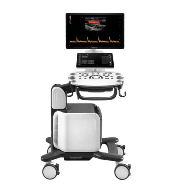Mindray Consona N6 Ultrasound Machine – Best Price in Bangladesh Mindray Consona N6 Ultrasound Machine – Best Price in Bangladesh