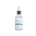 The Dermalix Niacinamide 4% + Alpha Arbutin 2% Brightening Serum 30ml